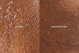 When Your Skin Feels Tight, Dull, or Never Quite Hydrated—There’s a Reason