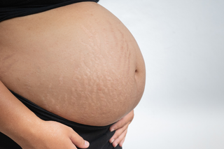 Stretch Marks & Belly Care: A Nourishing Routine for Soft, Comfortable Skin