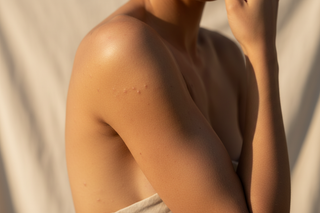 inclusive-body-shot-arms-shoulders-with-body-acne-and-rough-bumps-with-soft-highlight